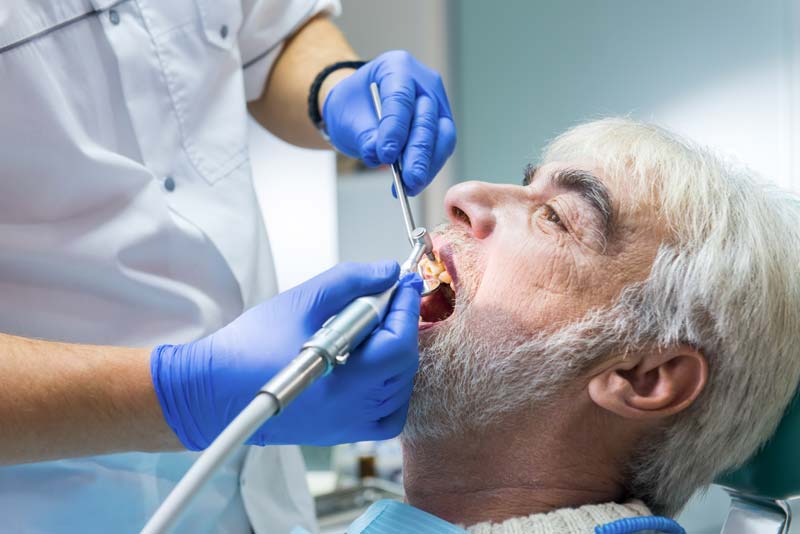 stomatologist-cleaning-teeth